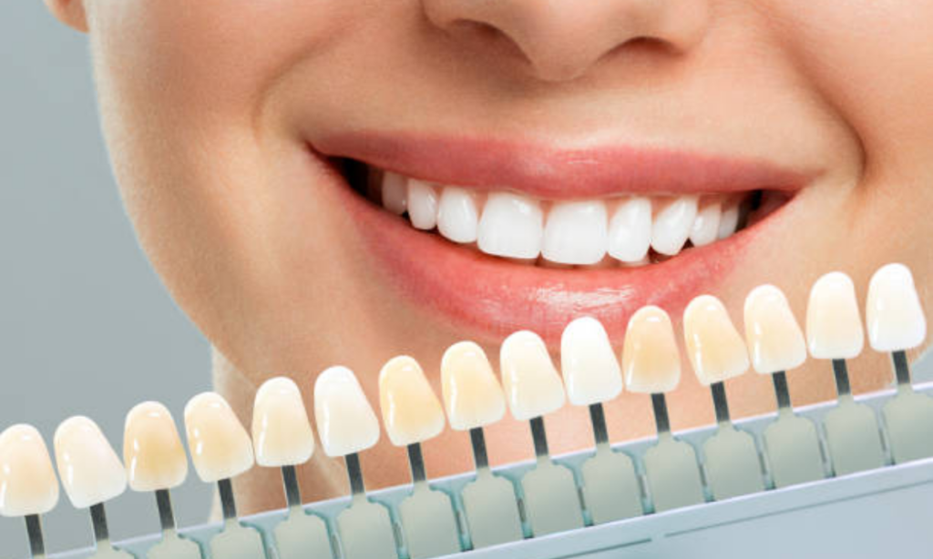 Cosmetic / Aesthetic Dental Treatment