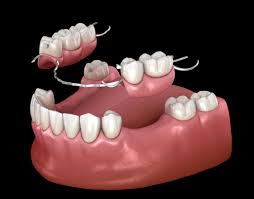 Complete and Partial Dentures